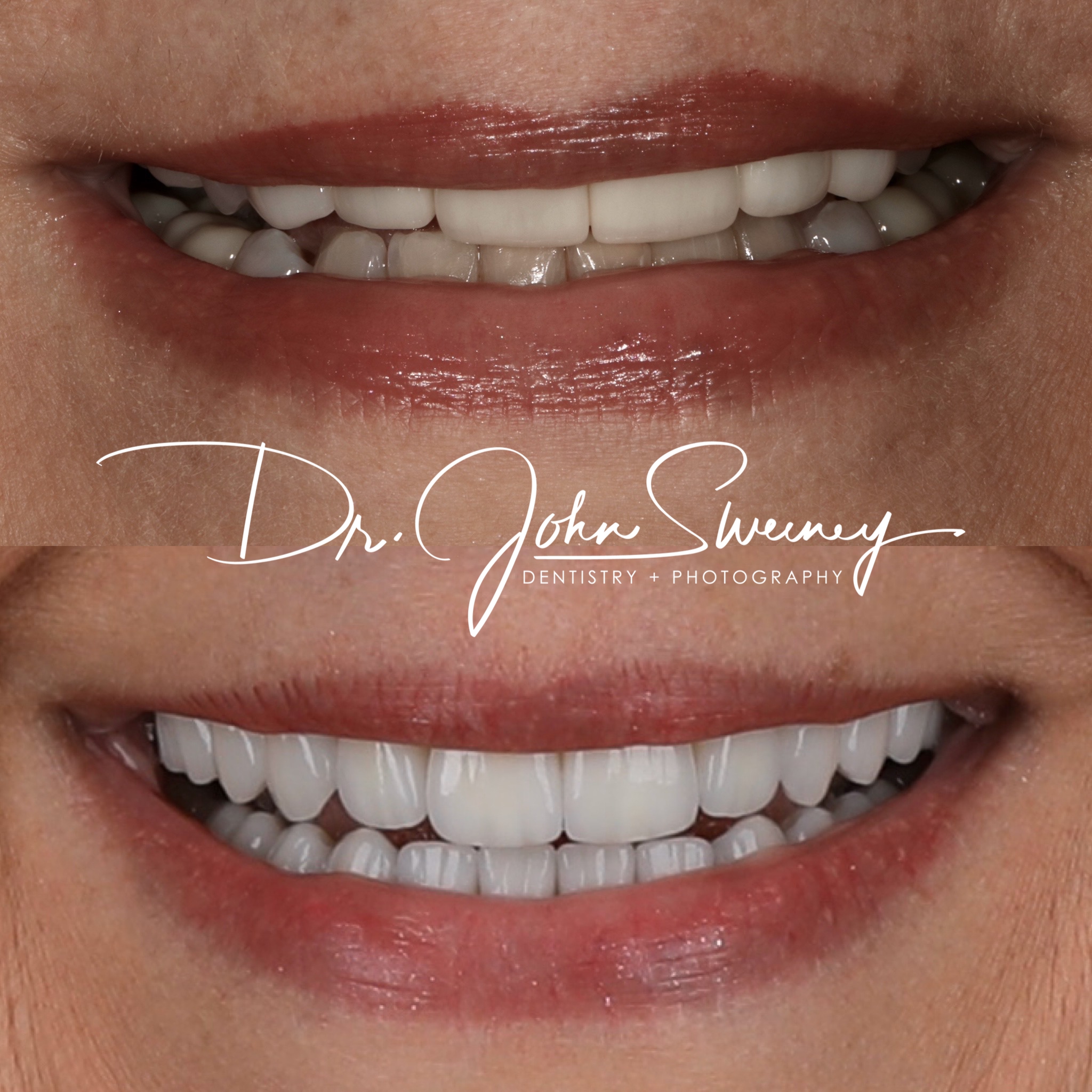 Focus dentistry patient before and after photo