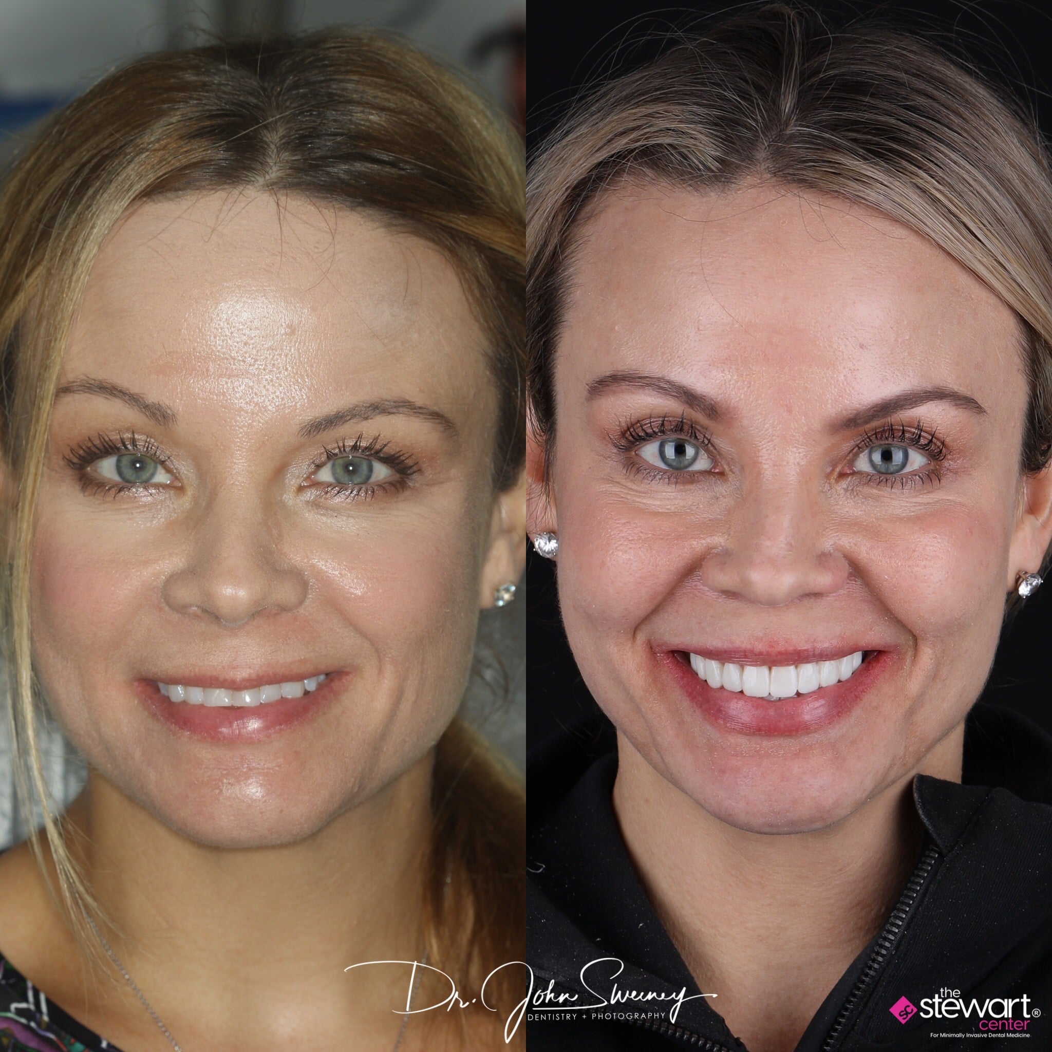 FOCUS Dentistry before and after photo