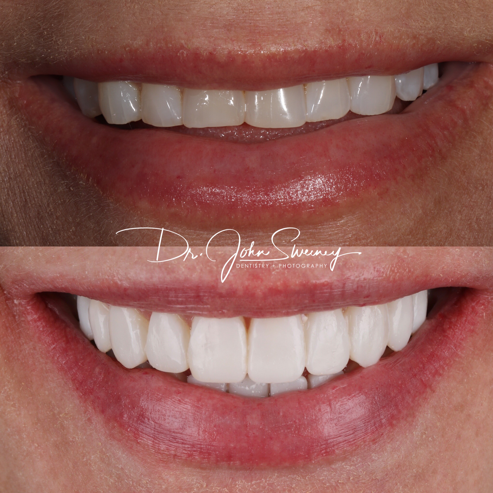 Focus dentistry patient before and after photo
