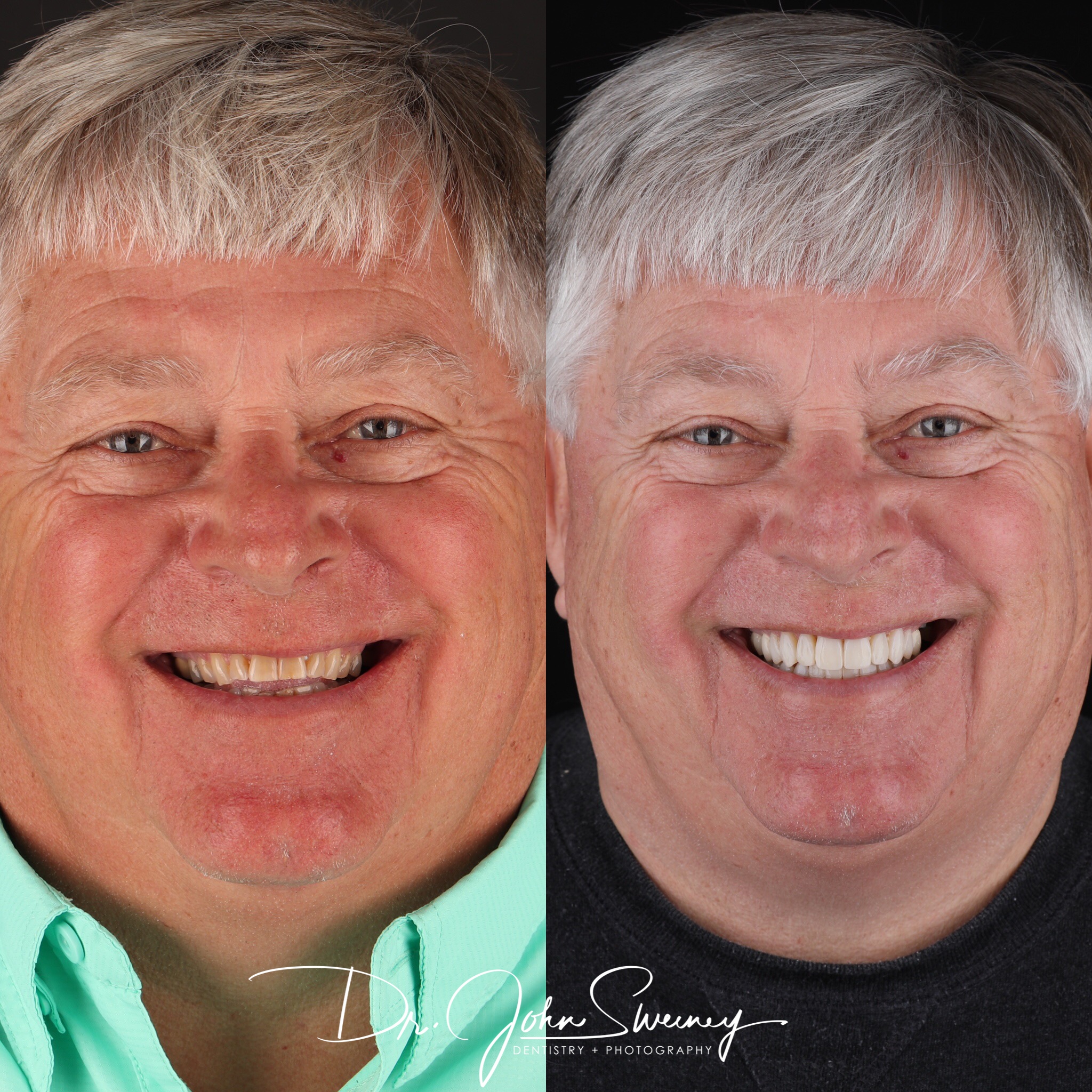 FOCUS Dentistry before and after photo