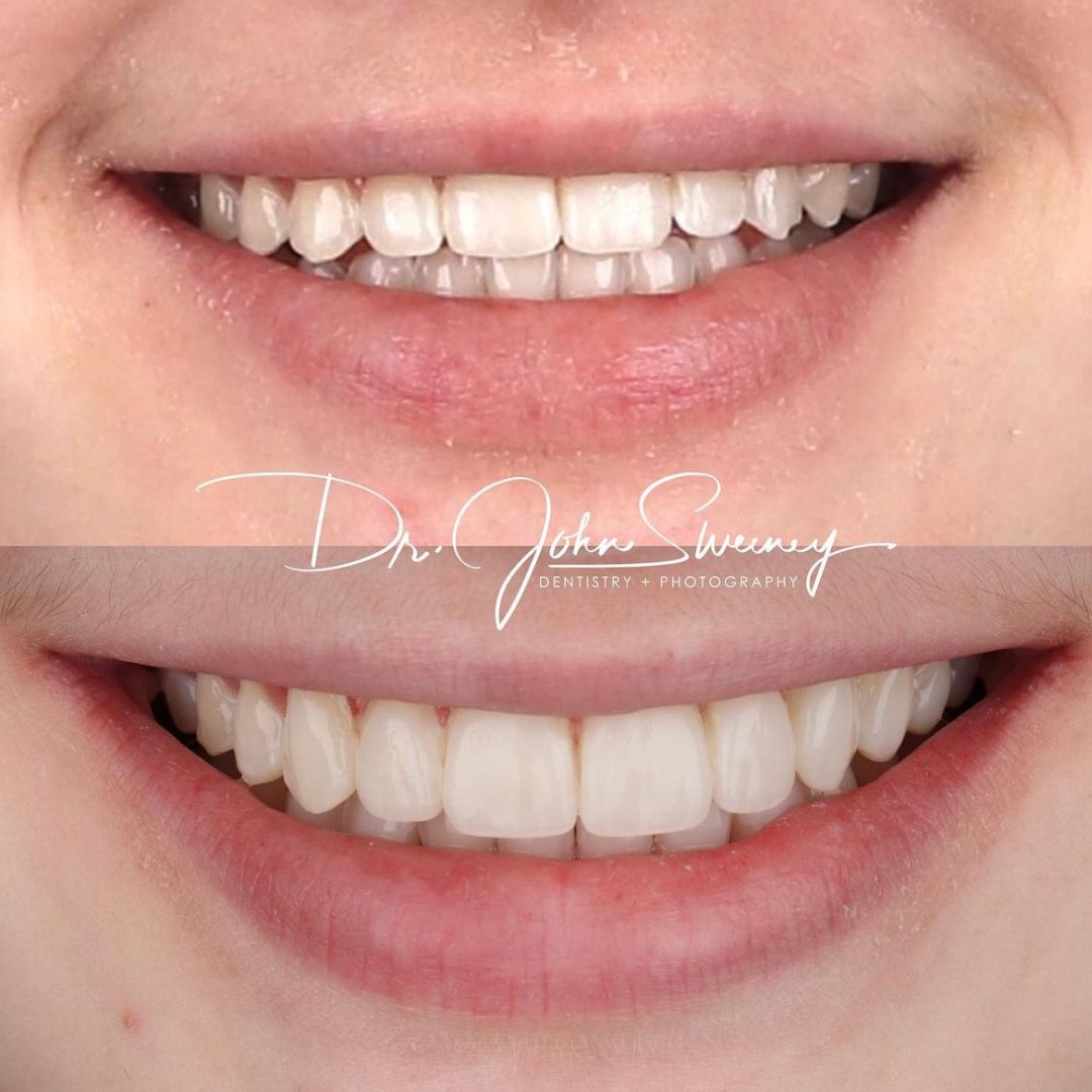 FOCUS Dentistry before and after photo