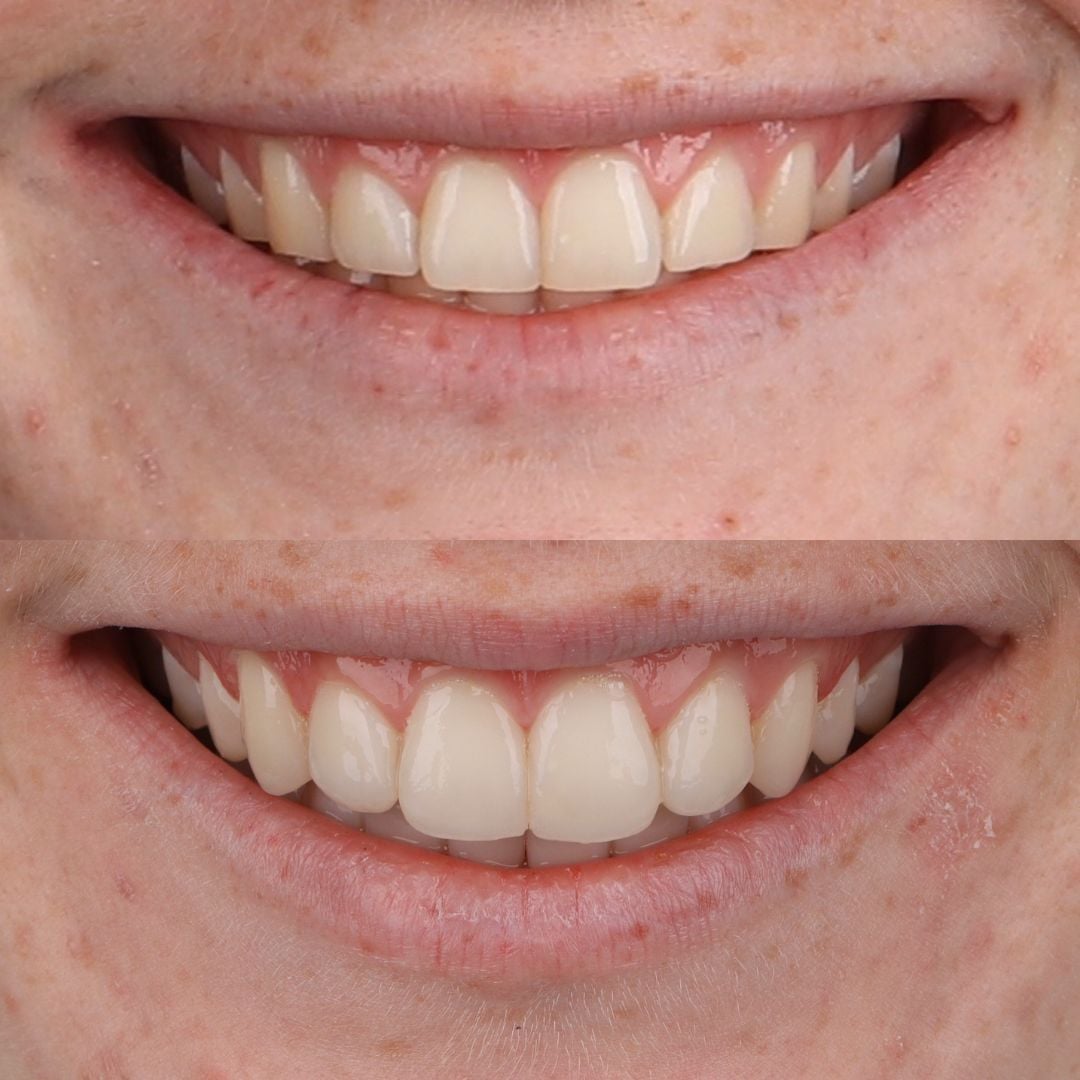 FOCUS Dentistry before and after photo