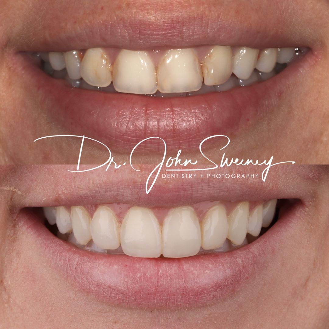 FOCUS Dentistry before and after photo