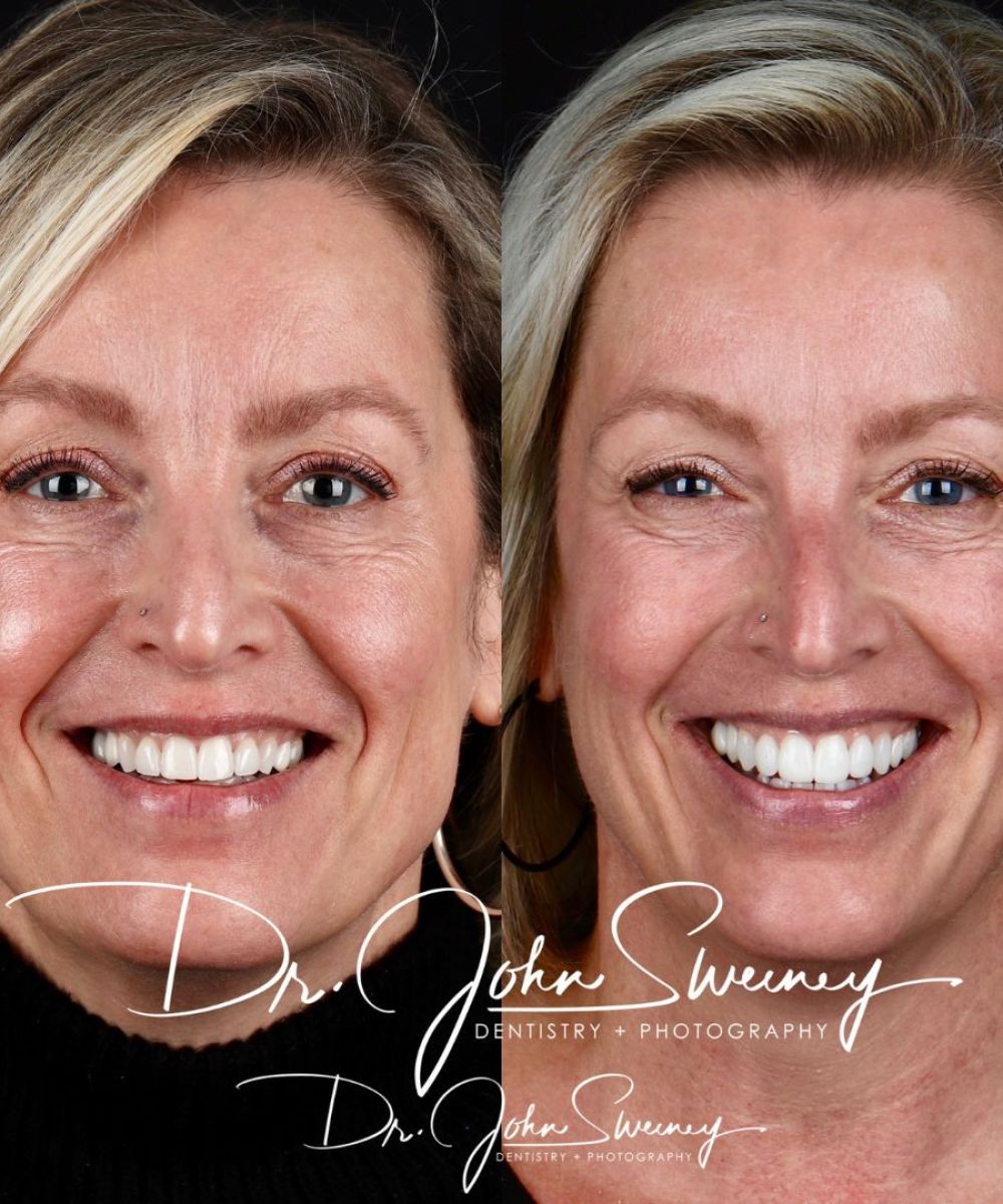 Focus-Dentistry-Case-Before-After