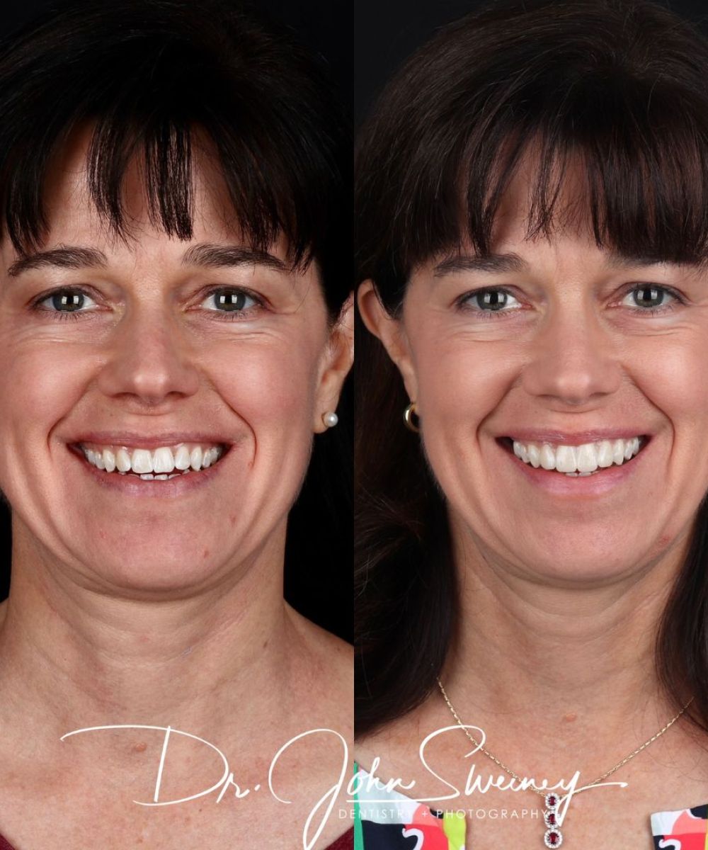 Patient of Focus Dentistry